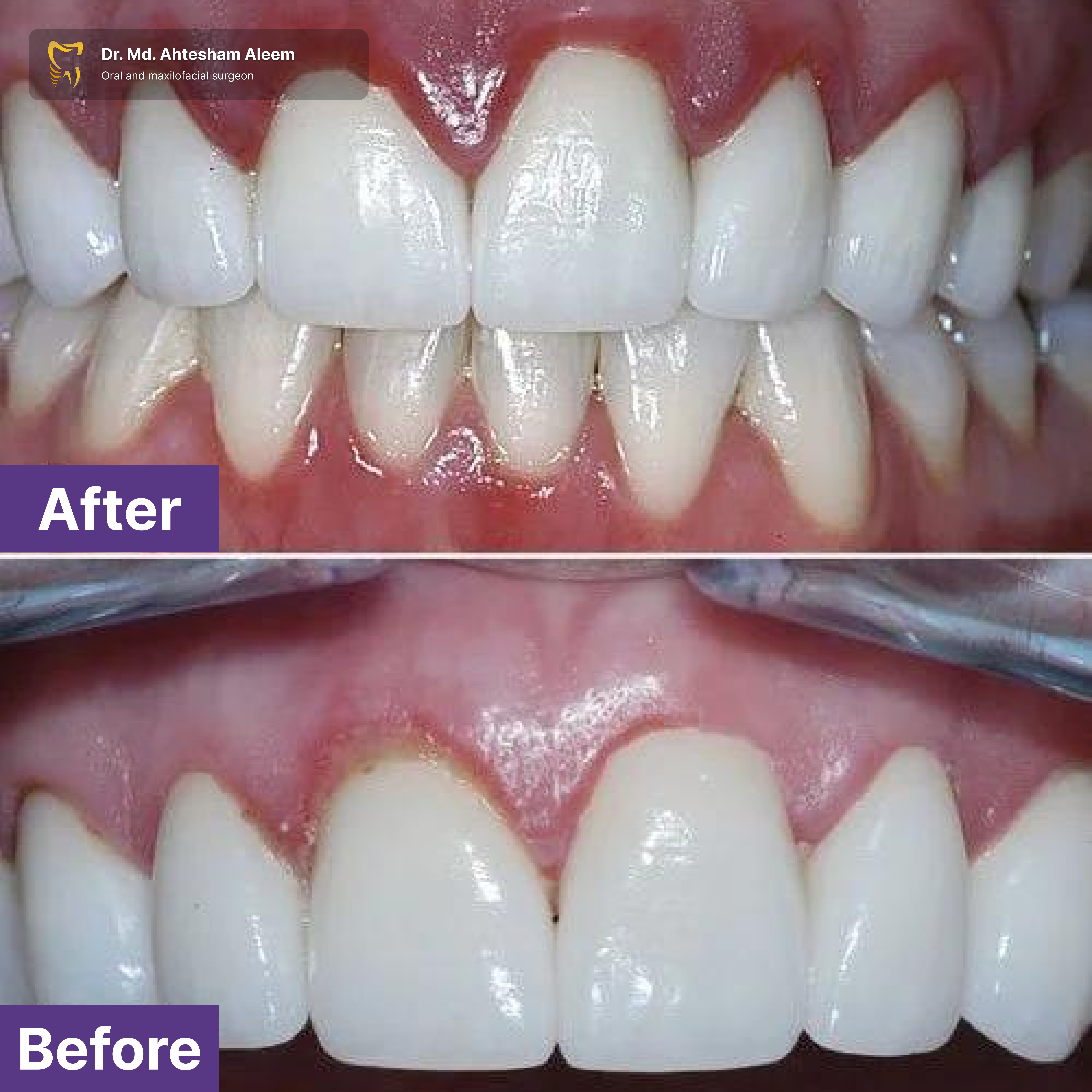 Advanced Laser Dentistry Gallery 2